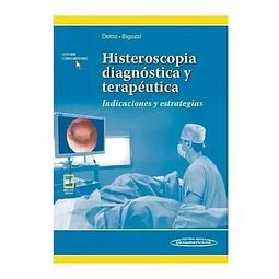 Histeroscopia diagnóstica y terapéutica