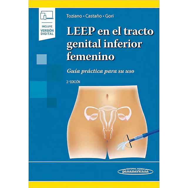 LEEP en el tracto genital inferior femenino