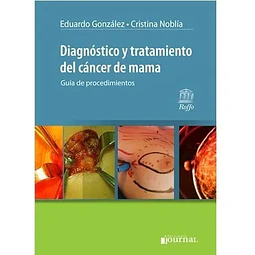 Diagnóstico y tratamiento del cáncer de mama