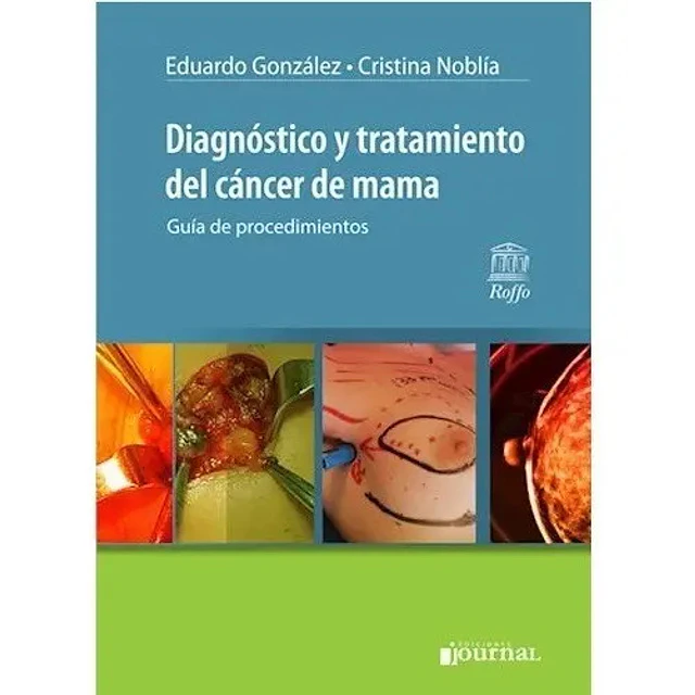 Diagnóstico y tratamiento del cáncer de mama
