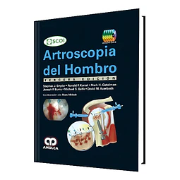 Artroscopia del Hombro