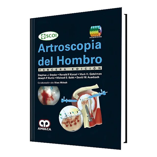 Artroscopia del Hombro
