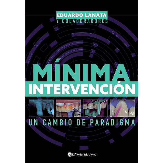 Mínima intervención un cambio de paradigma