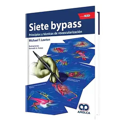 Siete Bypass