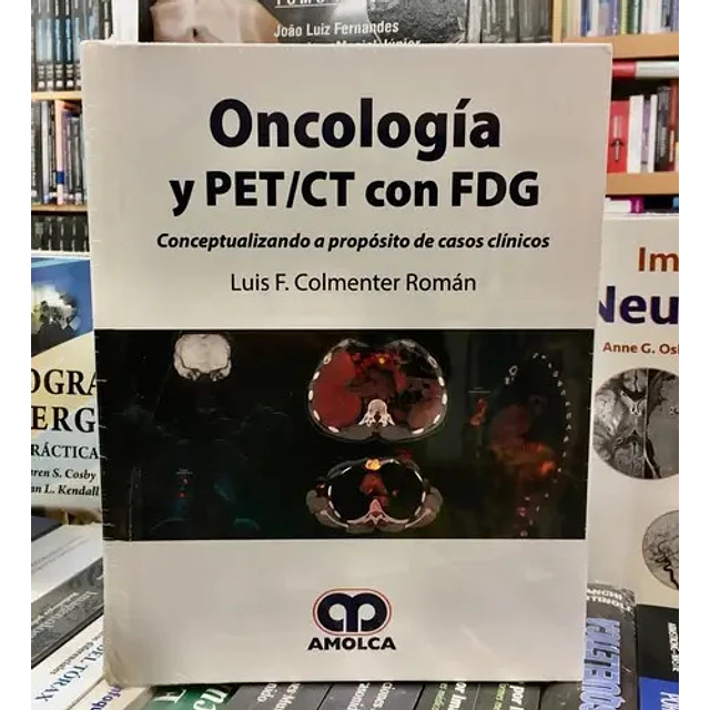 Oncología y PER/CT con FDG