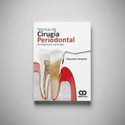 Técnicas de Cirugía Periodontal