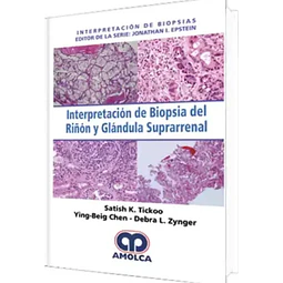 Interpretación de Biopsia del Riñón y Glándula Suprarrenal