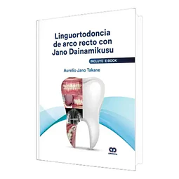 Linguortodoncia de arco recto con Jano Dainamikusu