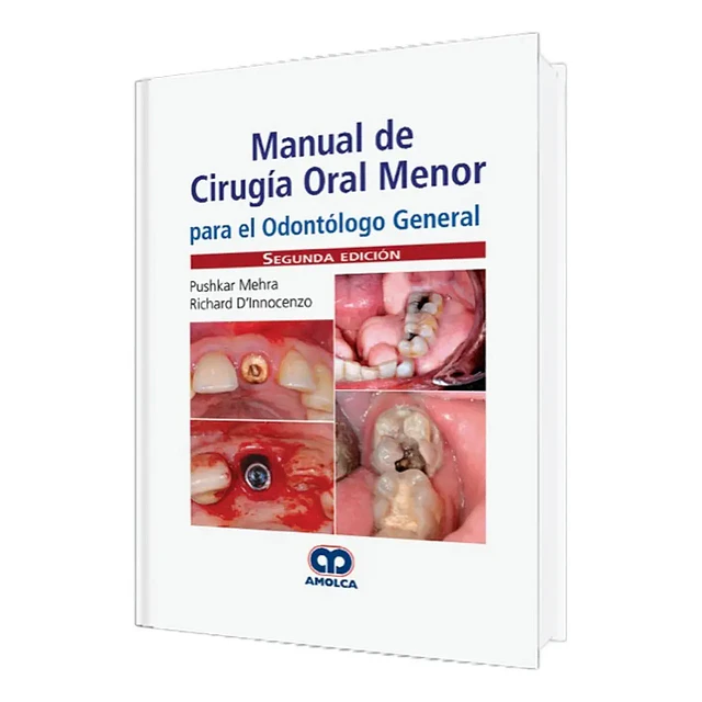 Manual de cirugía oral menor