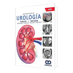 Imagenología en Urología