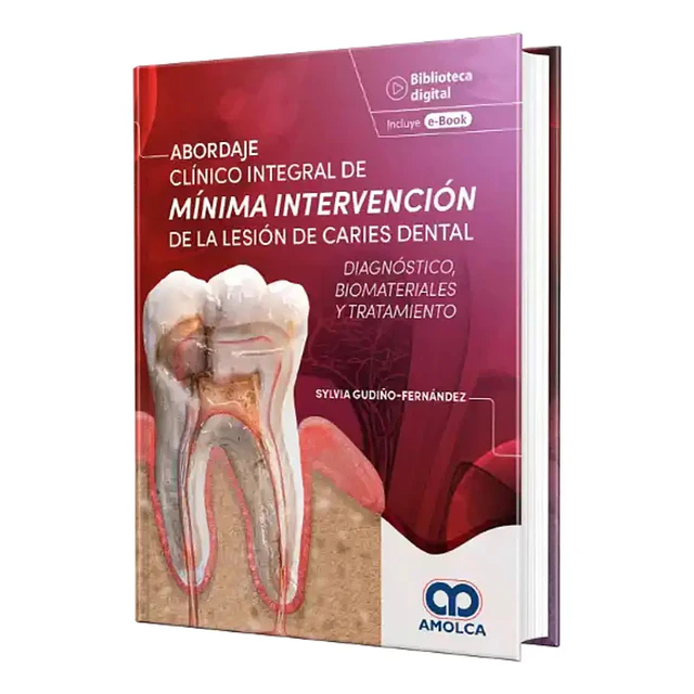 Abordaje clínico integral de mínima intervención de la lesión de caries dental