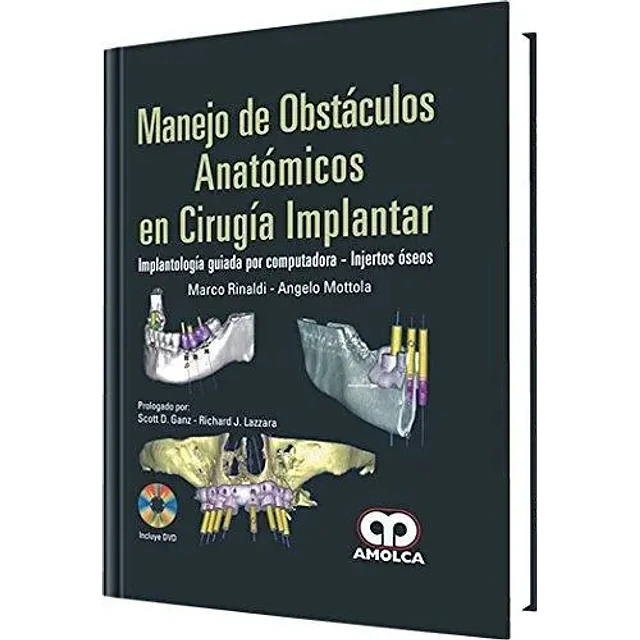 Manejo de Obstáculos Anatómicos en Cirugía Implantar