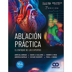 Ablación práctica