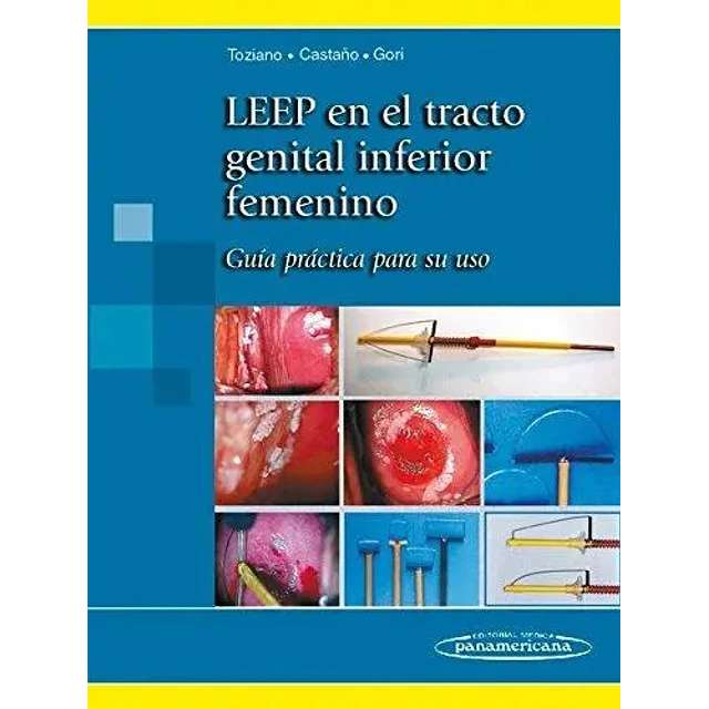 LEEP en el tracto genital inferior femenino
