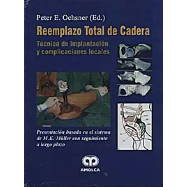 Reemplazo Total de cadera