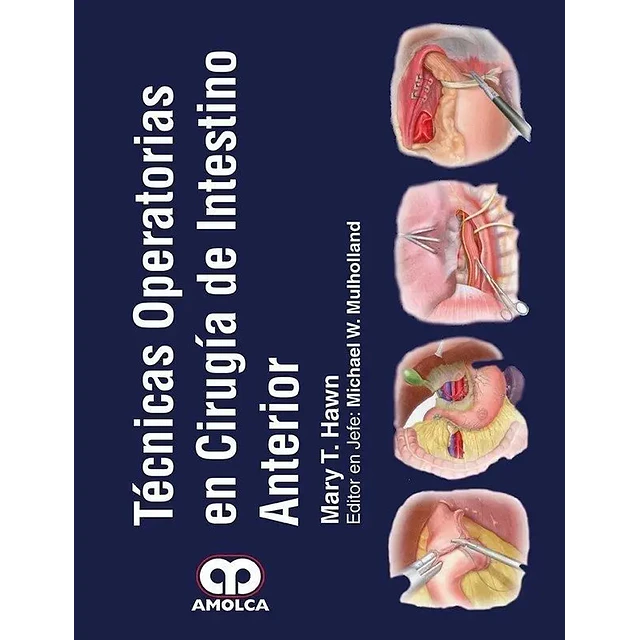 Técnicas Operatorias en Cirugía de Intestino Anterior