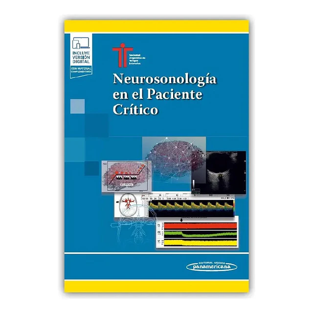 Neurosonología en el paciente crítico SATI