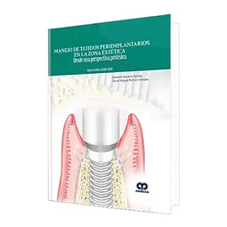 Manejo de Tejidos Periimplantarios en la Zona Estética