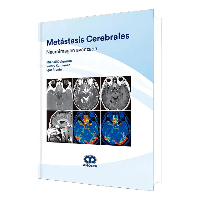 Metástasis Cerebrales