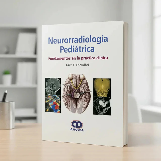 Neurorradiología Pediátrica