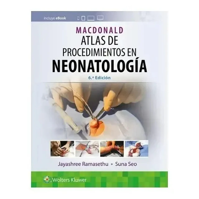 MACDONALD Atlas de procedimientos en neonatología