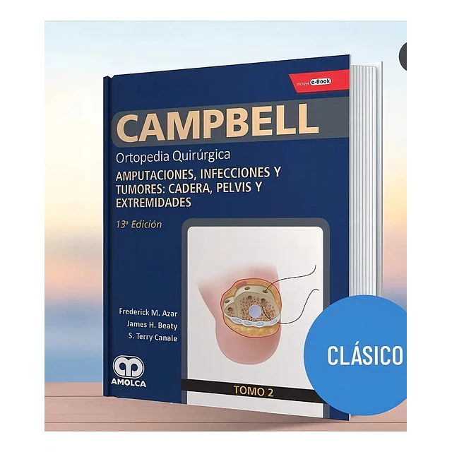 Ortopedia Quirúrgica Campbell - Tomo 2