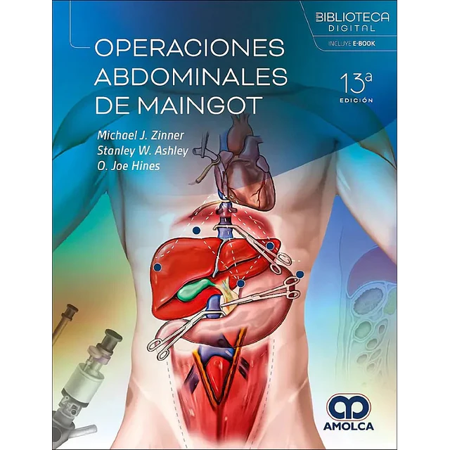 Operaciones abdominales de Maingot