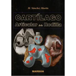 Cartílago articular de la rodilla