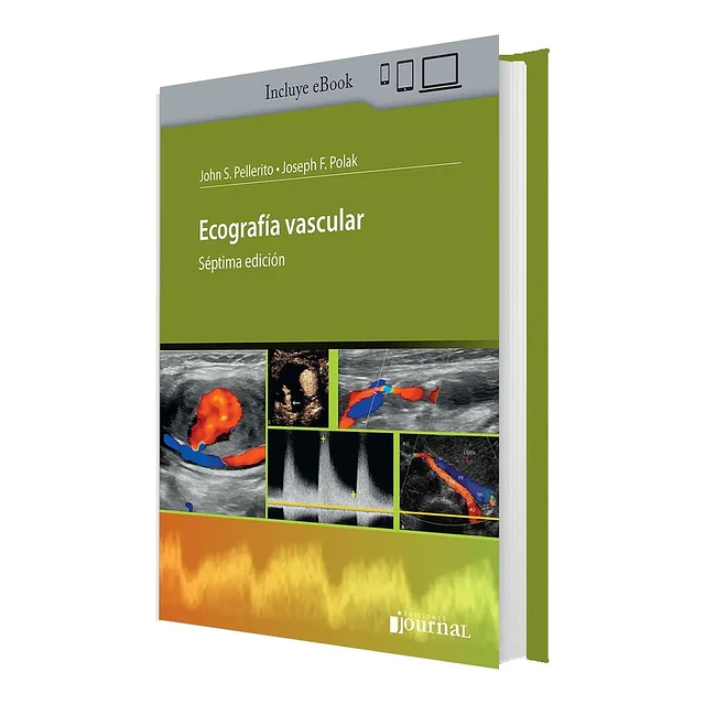 Ecografia Vascular