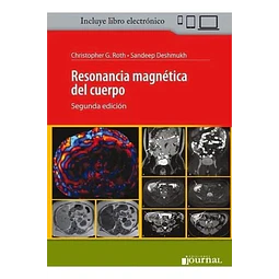 Resonancia magnetica del cuerpo