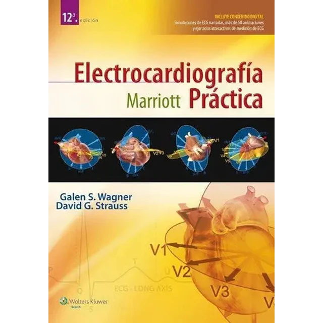 Electrocardiografía Práctica Marriott