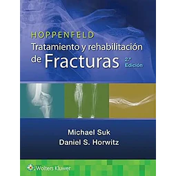 Hoppenfeld. Tratamiento y rehabilitación de fracturas