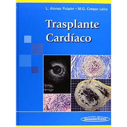 Trasplante Cardíaco