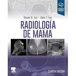 Radiología de la mama