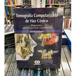 Tomografia Computarizada de Haz Cónico