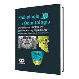 Radiología 3D en Odontología