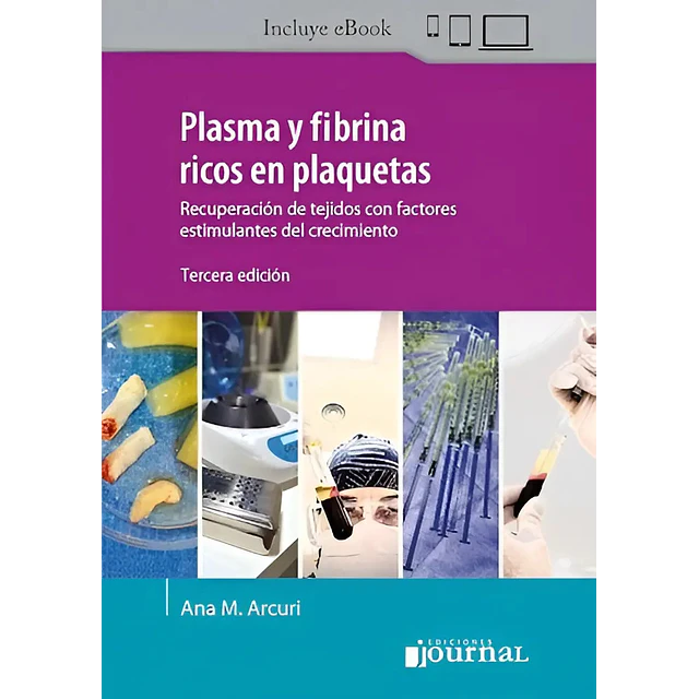 Plasma y fibrina ricos en plaquetas