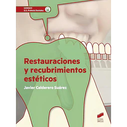Restauraciones y recubrimientos estéticos