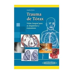 Trauma de Tórax