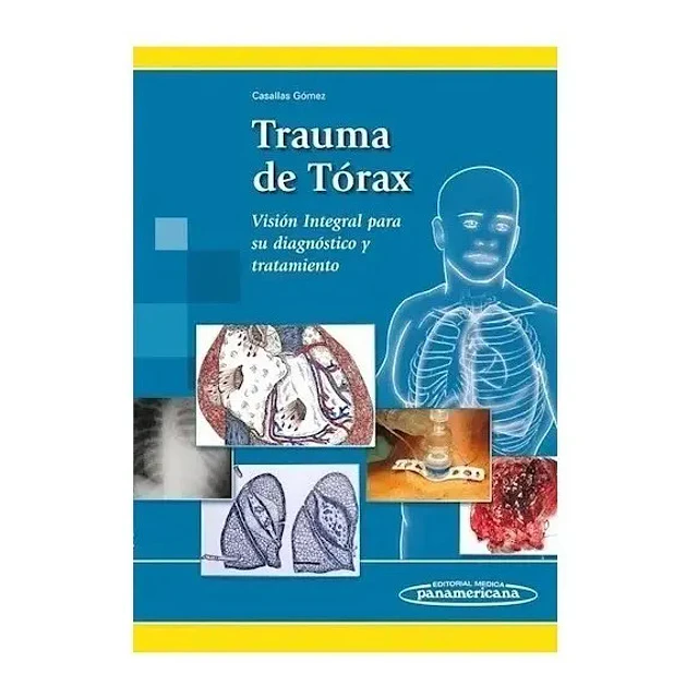 Trauma de Tórax