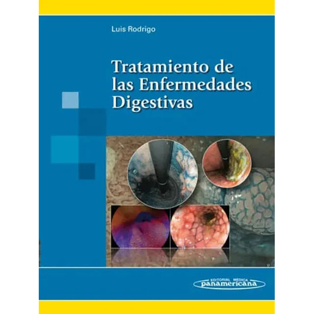 Tratamiento de las Enfermedades Digestivas