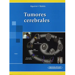 Tumores Cerebrales - Tomo 1