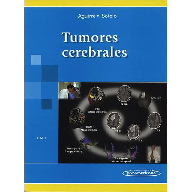 Tumores Cerebrales - Tomo 1