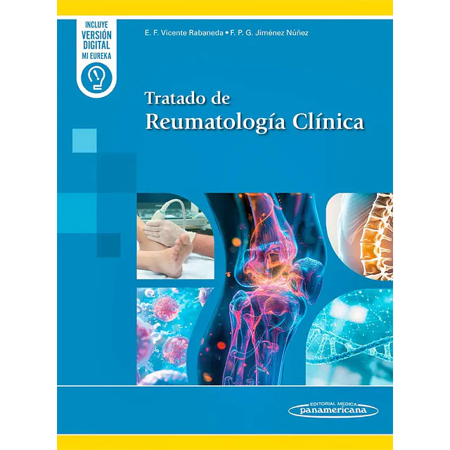 Tratado de reumatología clínica