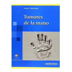 Tumores de la Mano