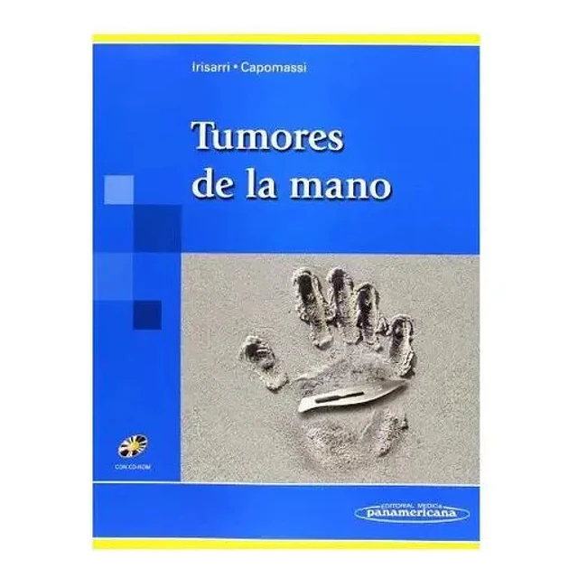 Tumores de la Mano