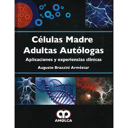 Células madre adultas autólogas