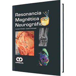 Resonancia Magnética Neurográfica