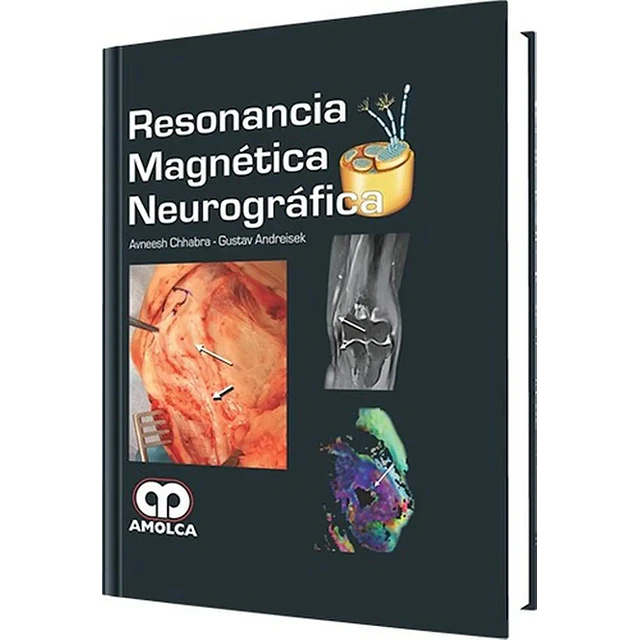 Resonancia Magnética Neurográfica