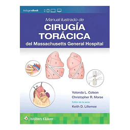 Manual ilustrado de Cirugía torácica del Massachusetts General Hospital